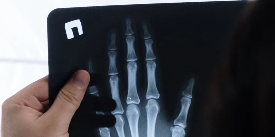 Beratung 20 krankenversicherung roentgenbild min